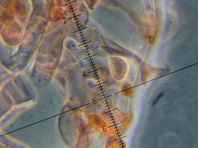 Botryobasidium con spore finemente verrucose